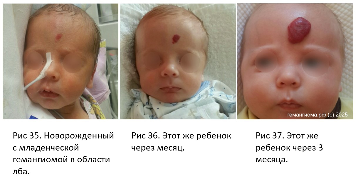 Фото из книги "Гемангиома" автор Романов Д.В.